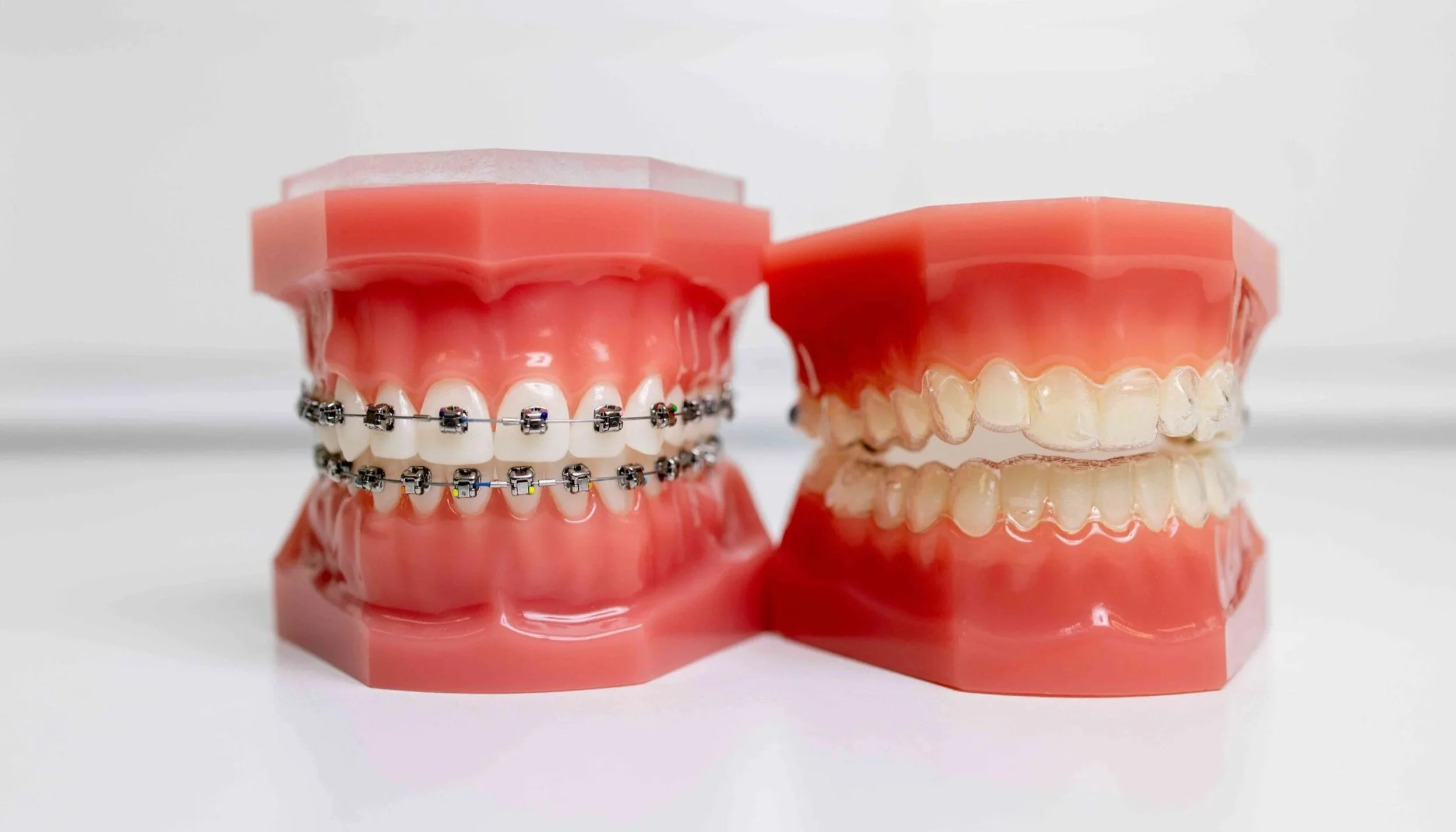 Braces at best orthodontist in Upper West Side Manhattan