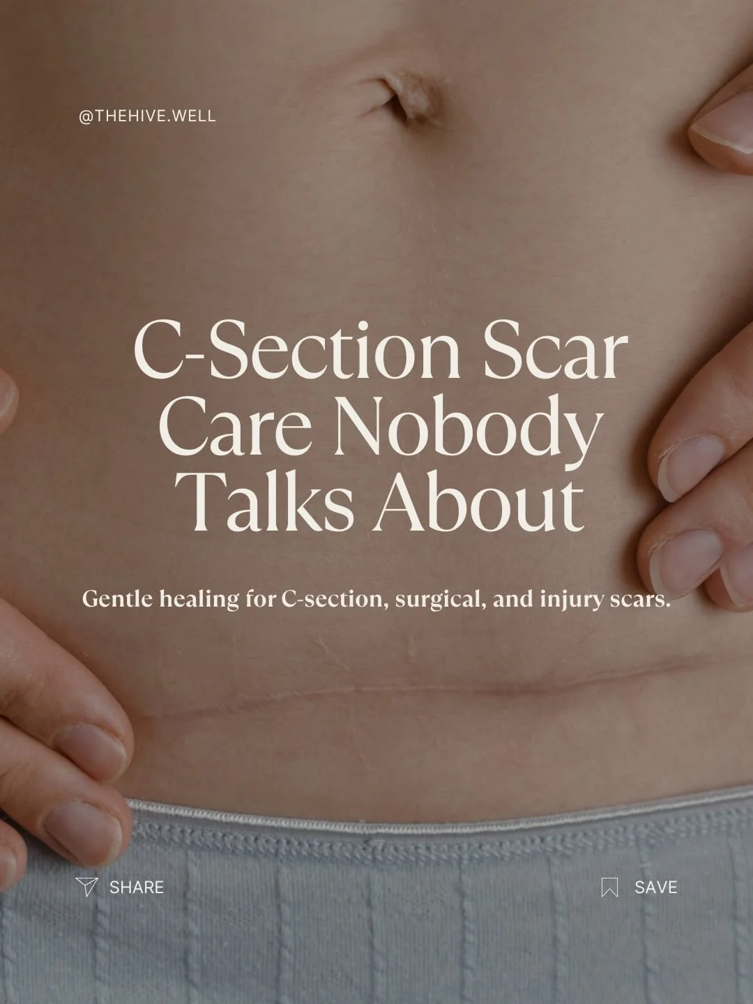 Your C-section scar is so much more than a line on your skin &mdash; it&rsquo;s a doorway your body had to heal through. And even after it closes, the deeper layers can hold tension, numbness, puffiness, pain, and restricted movement that many new mo