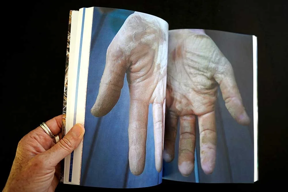 A hand holding open a book featuring large photographs of an old, wrinkled hand with a long, thick finger that appears to be deformed or mutated.