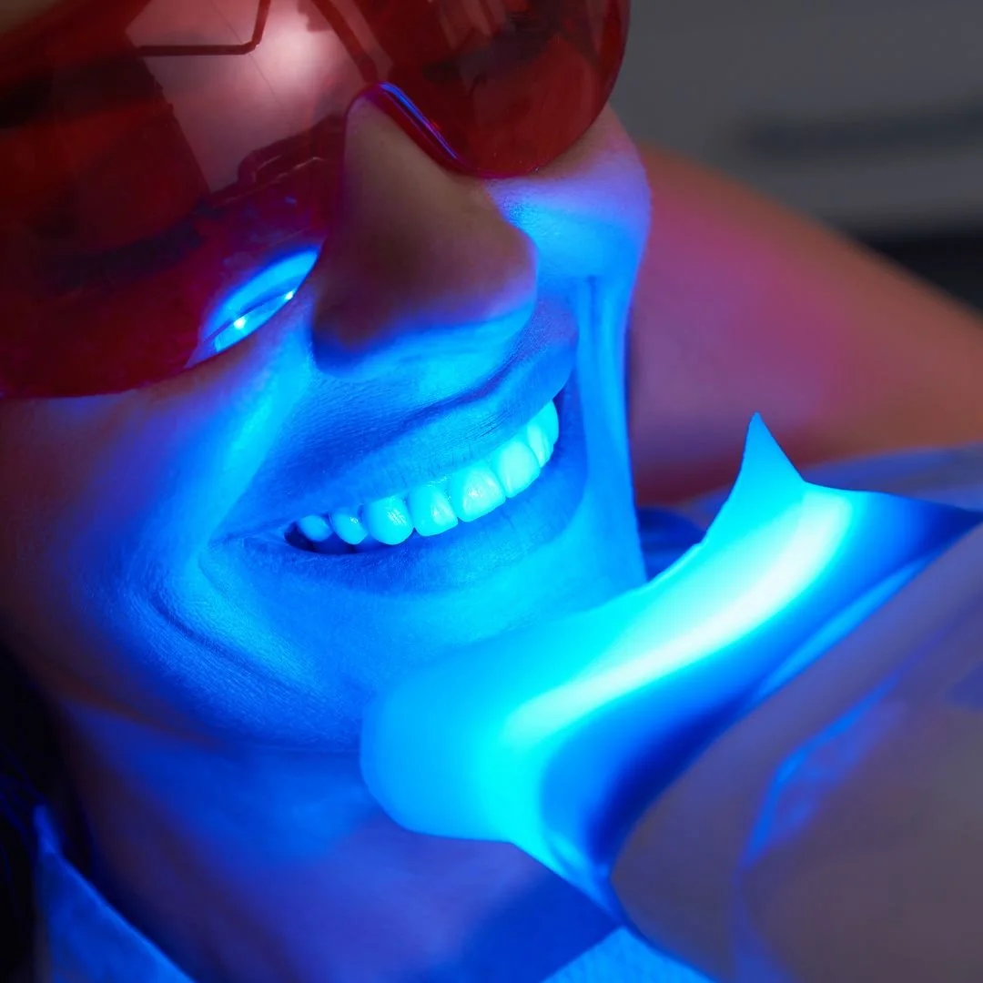 Close-up of a person smiling with white teeth wearing red protective glasses, illuminated by blue light from a uv light device.