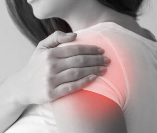 Why Your Shoulder Impingement Won’t Go Away (Even After PT)