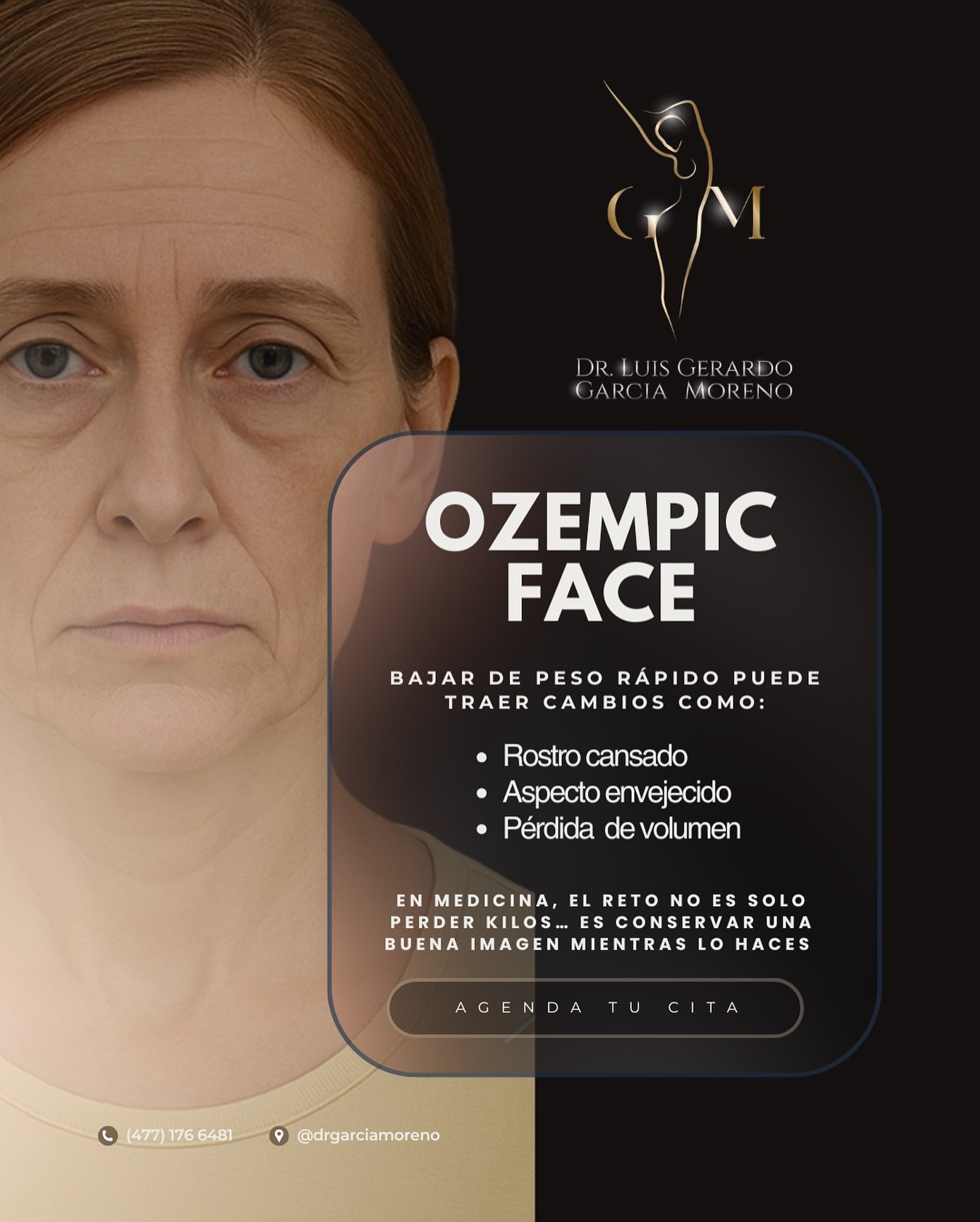 📍 Agenda tu valoraci&oacute;n m&eacute;dica y descubre qu&eacute; tratamiento es ideal para ti.

Dr. Luis Gerardo Garc&iacute;a Moreno | Cirujano Pl&aacute;stico Reconstructivo
Especialista en Cirug&iacute;a Facial y Corporal.
Innovaci&oacute;n en T