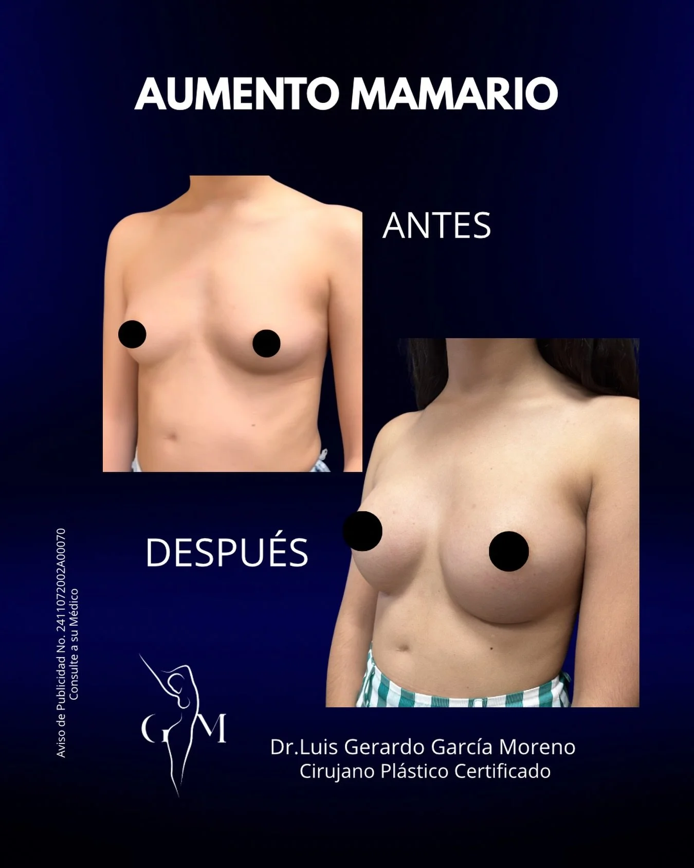 Valoraci&oacute;n m&eacute;dica, diagn&oacute;stico correcto
y un plan adecuado hacen toda la diferencia.

Agenda tu cita.
Dr. Luis Gerardo Garc&iacute;a Moreno | Cirujano Pl&aacute;stico Reconstructivo
Especialista en Cirug&iacute;a Facial y Corpora