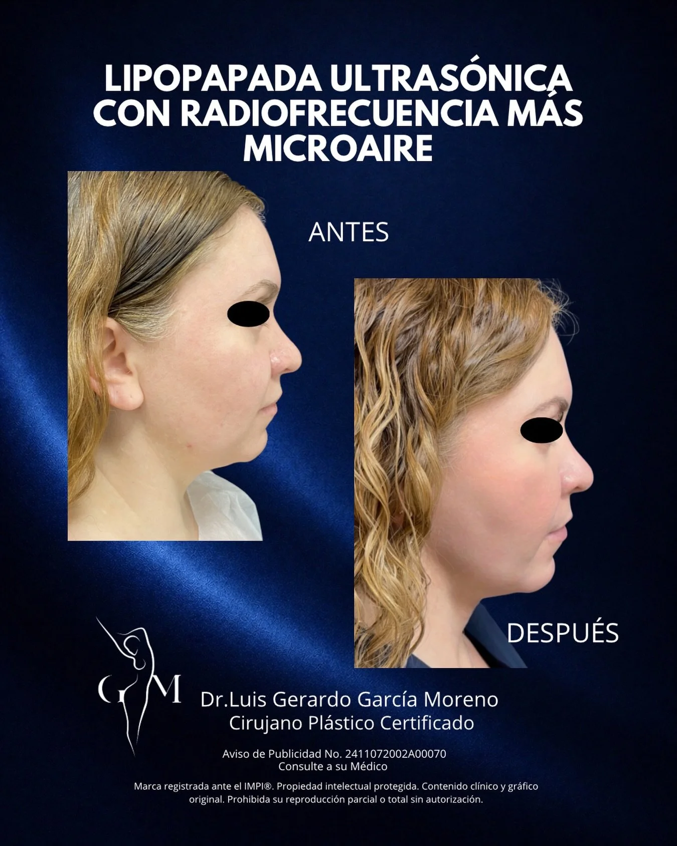 Agenda tu valoraci&oacute;n.

Dr. Luis Gerardo Garc&iacute;a Moreno | Cirujano Pl&aacute;stico Reconstructivo
Especialista en Cirug&iacute;a Facial y Corporal.
Innovaci&oacute;n en Tratamientos Avanzados con Tecnolog&iacute;a 
Redefiniendo la belleza