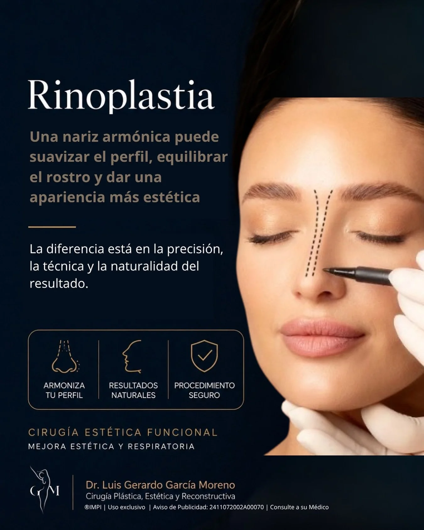 Una buena rinoplastia requiere precisi&oacute;n, an&aacute;lisis facial y visi&oacute;n m&eacute;dica&hellip; no solo &ldquo;hacer una nariz peque&ntilde;a&rdquo;.

Porque lo m&aacute;s elegante en cirug&iacute;a pl&aacute;stica es que el resultado s