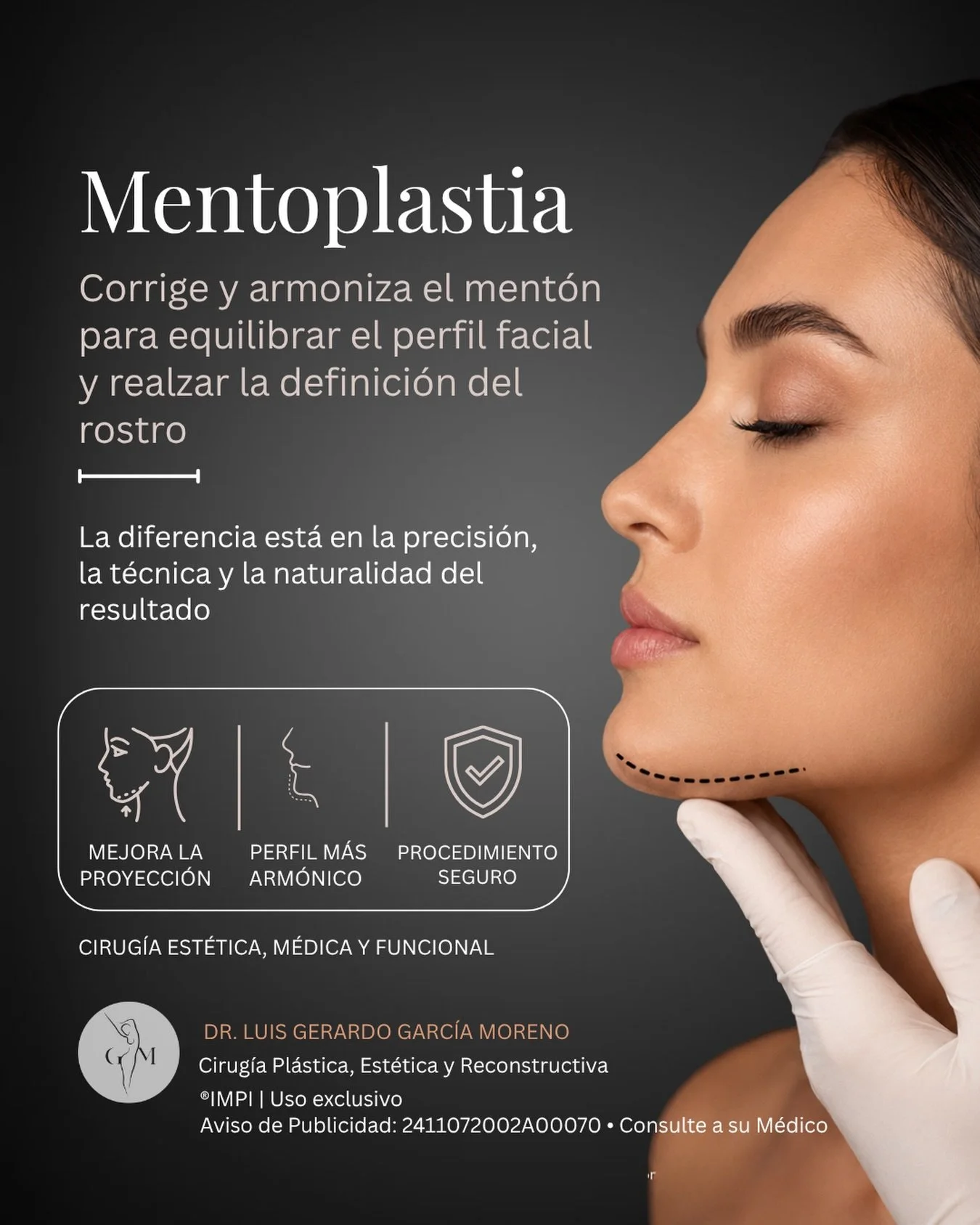 La armon&iacute;a facial no depende &uacute;nicamente de la nariz, los labios o los p&oacute;mulos. En muchos casos, el ment&oacute;n juega un papel fundamental en el equilibrio del rostro.

La mentoplastia es un procedimiento que permite mejorar la 