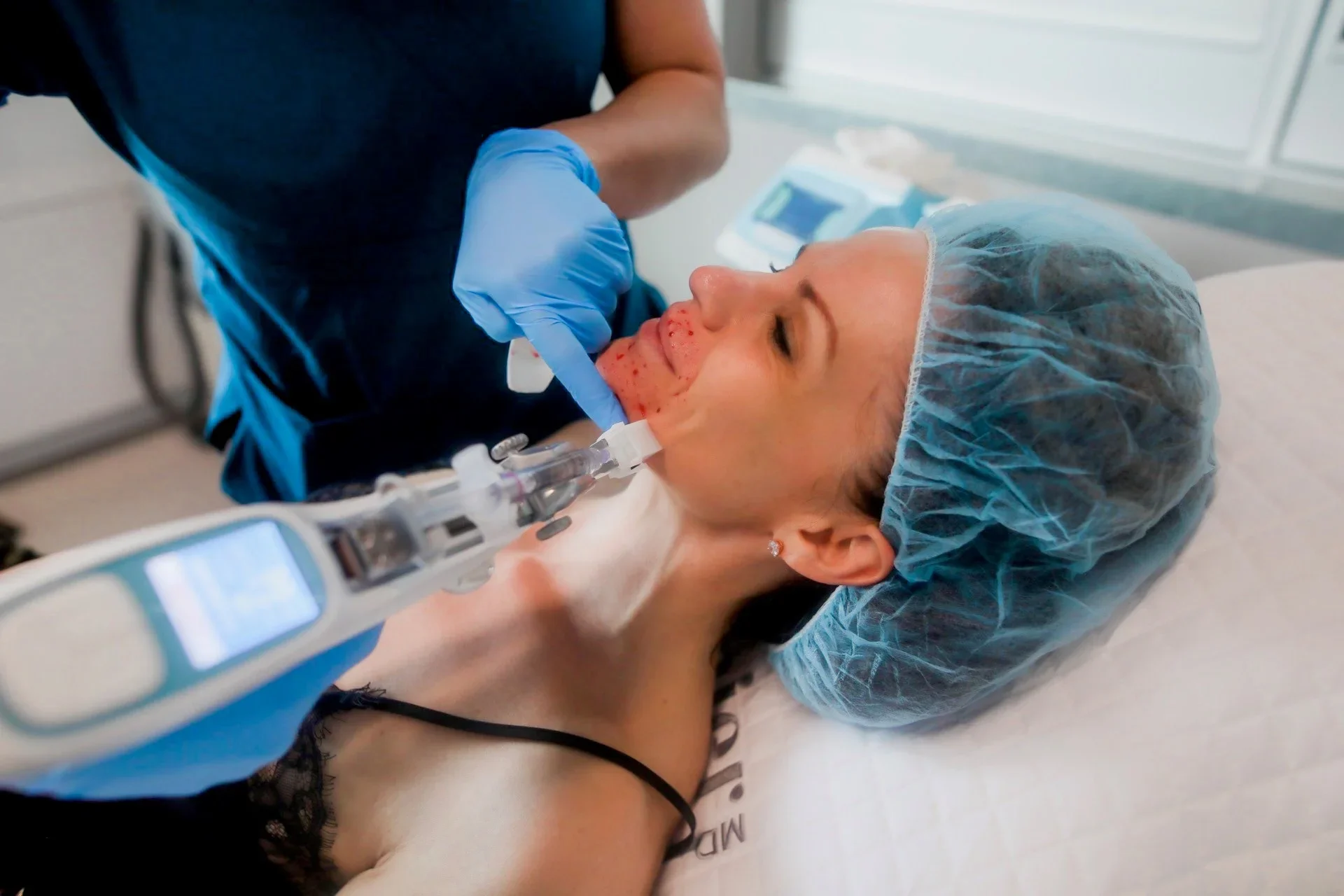 A woman lying in a hospital bed with a medical cap on her head, receiving medical treatment from a healthcare worker wearing gloves. The healthcare worker is possibly administering medication or performing a medical procedure, with medical equipment and monitors visible in the background.