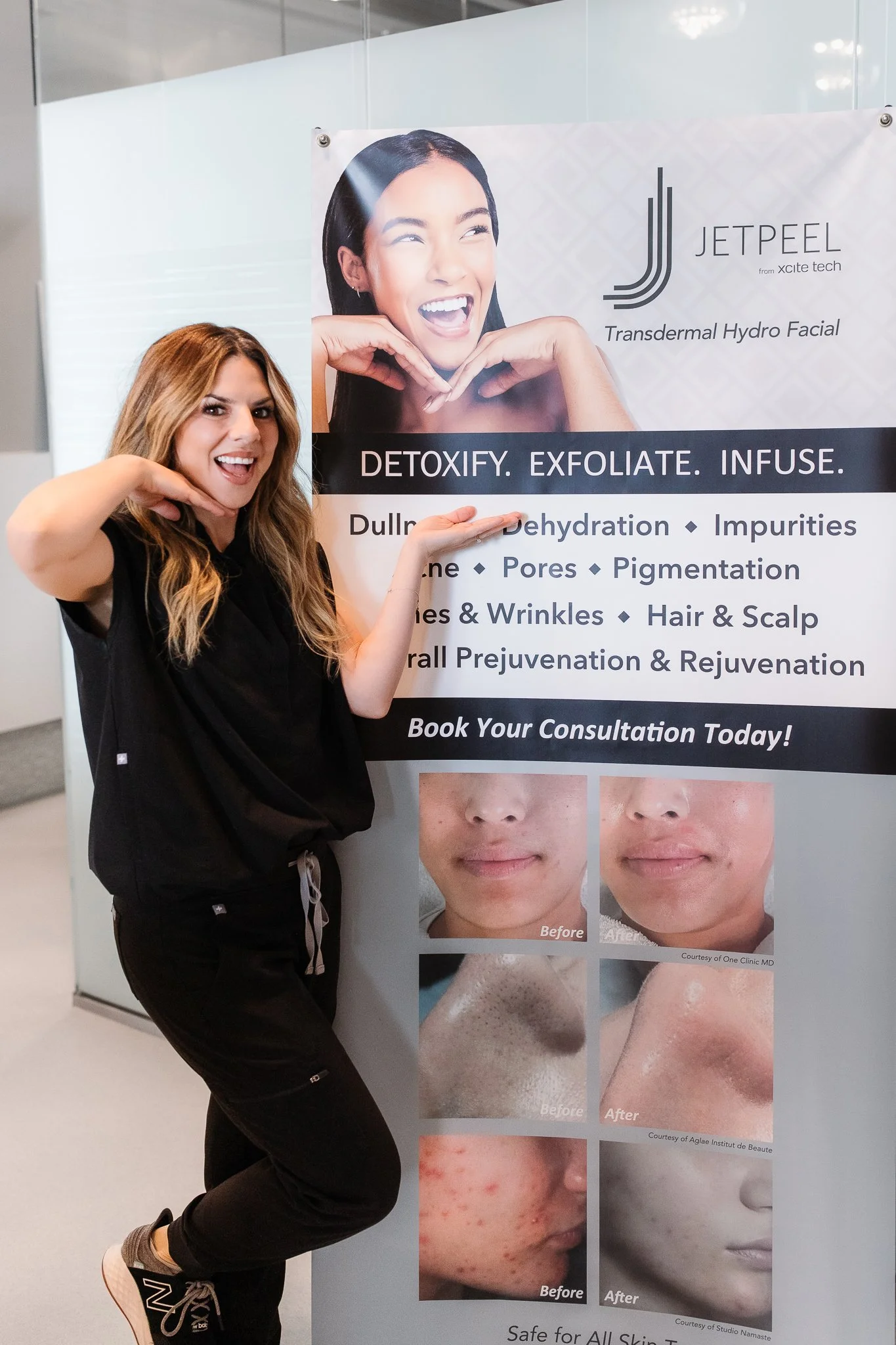 A woman posing next to a promotional poster for JetPeel, a transdermal hydro facial treatment, showing smiling and giving a thumbs up. The poster lists benefits like detoxifying, exfoliating, infusing, and improving skin conditions with before and after images.