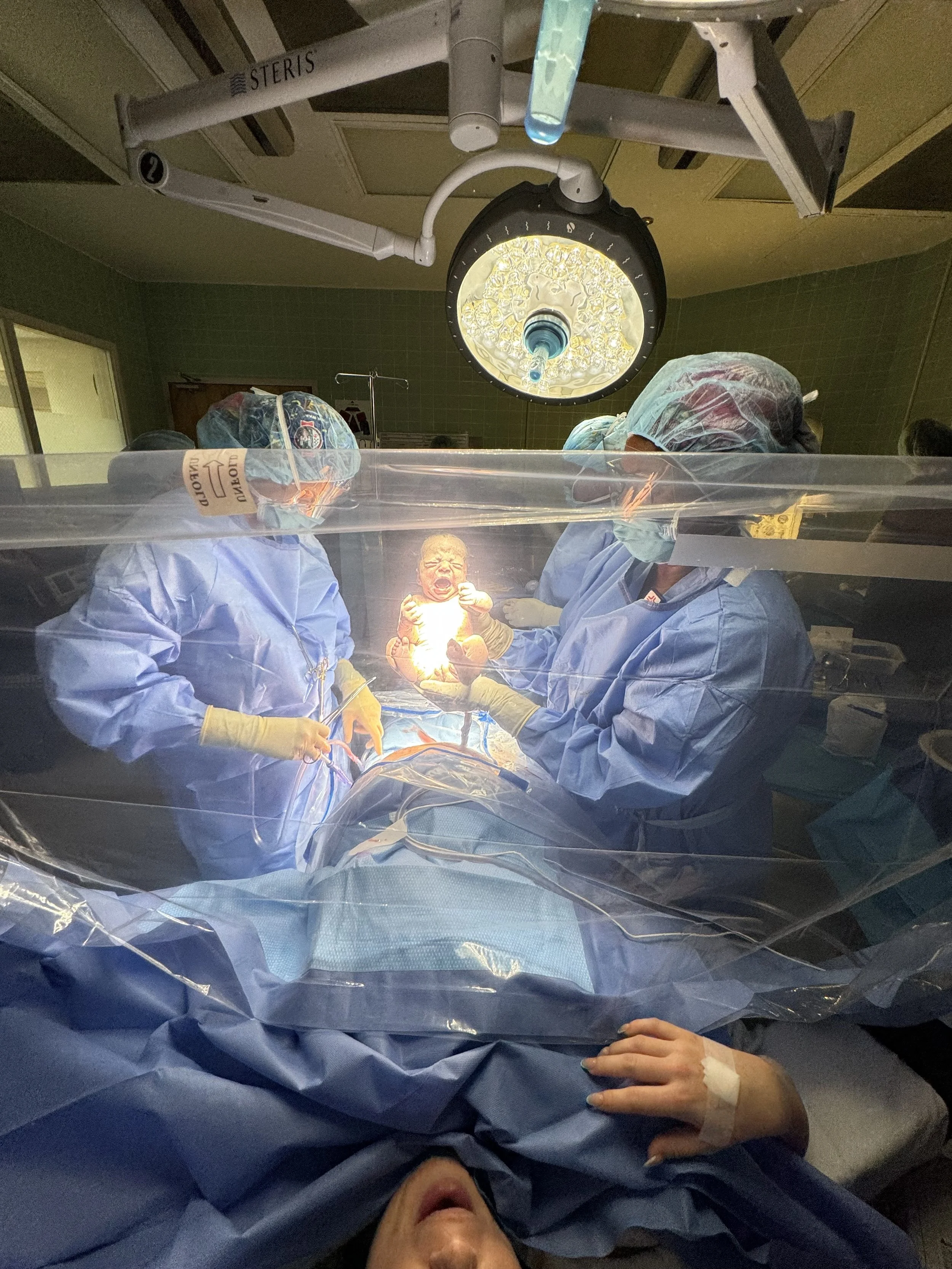 cesarean birth support, belly birth doula, surgical birth, full circle memorial Jax