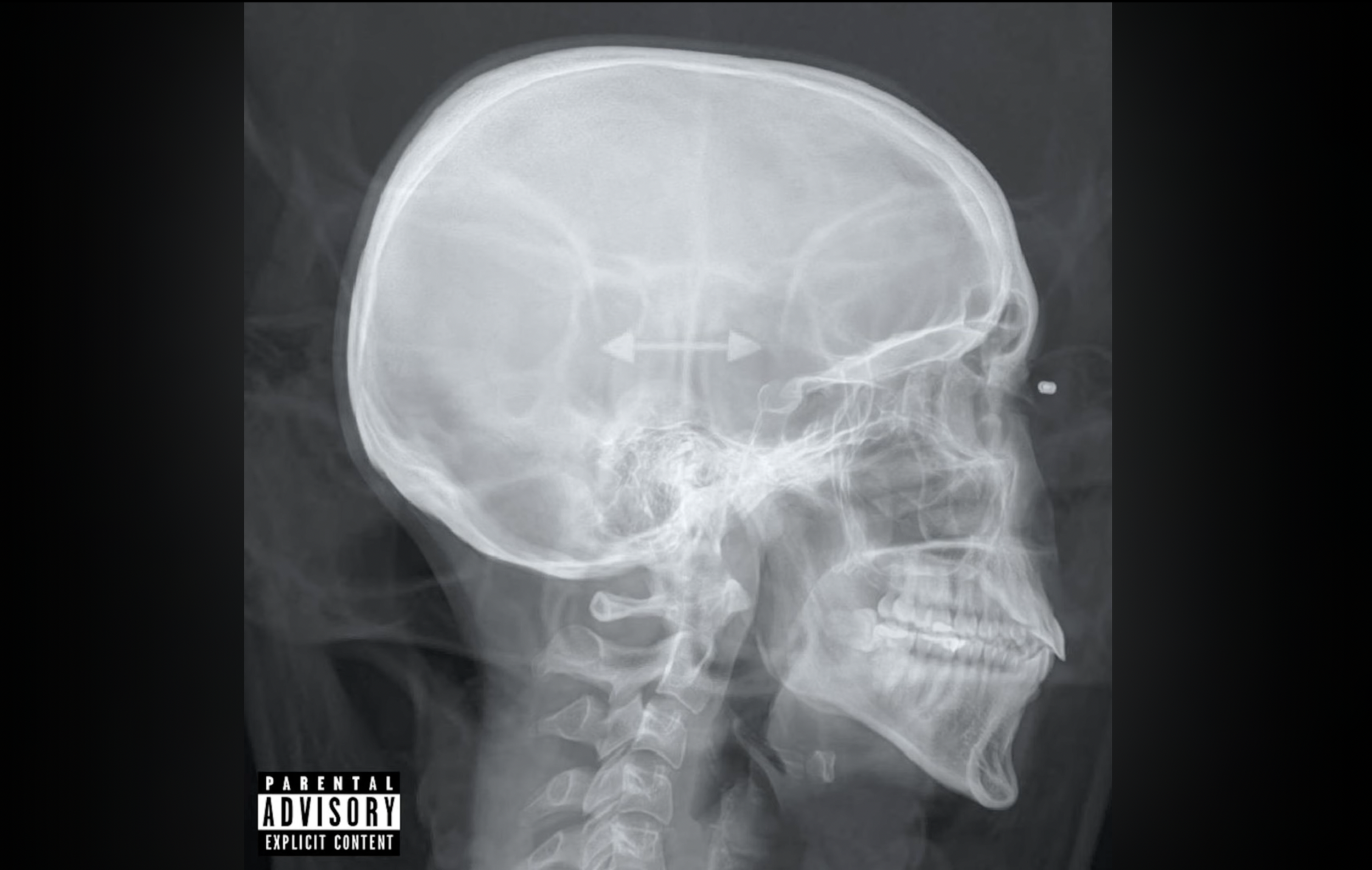 SIIICKBRAIN - Psychopath (Official Music Video)