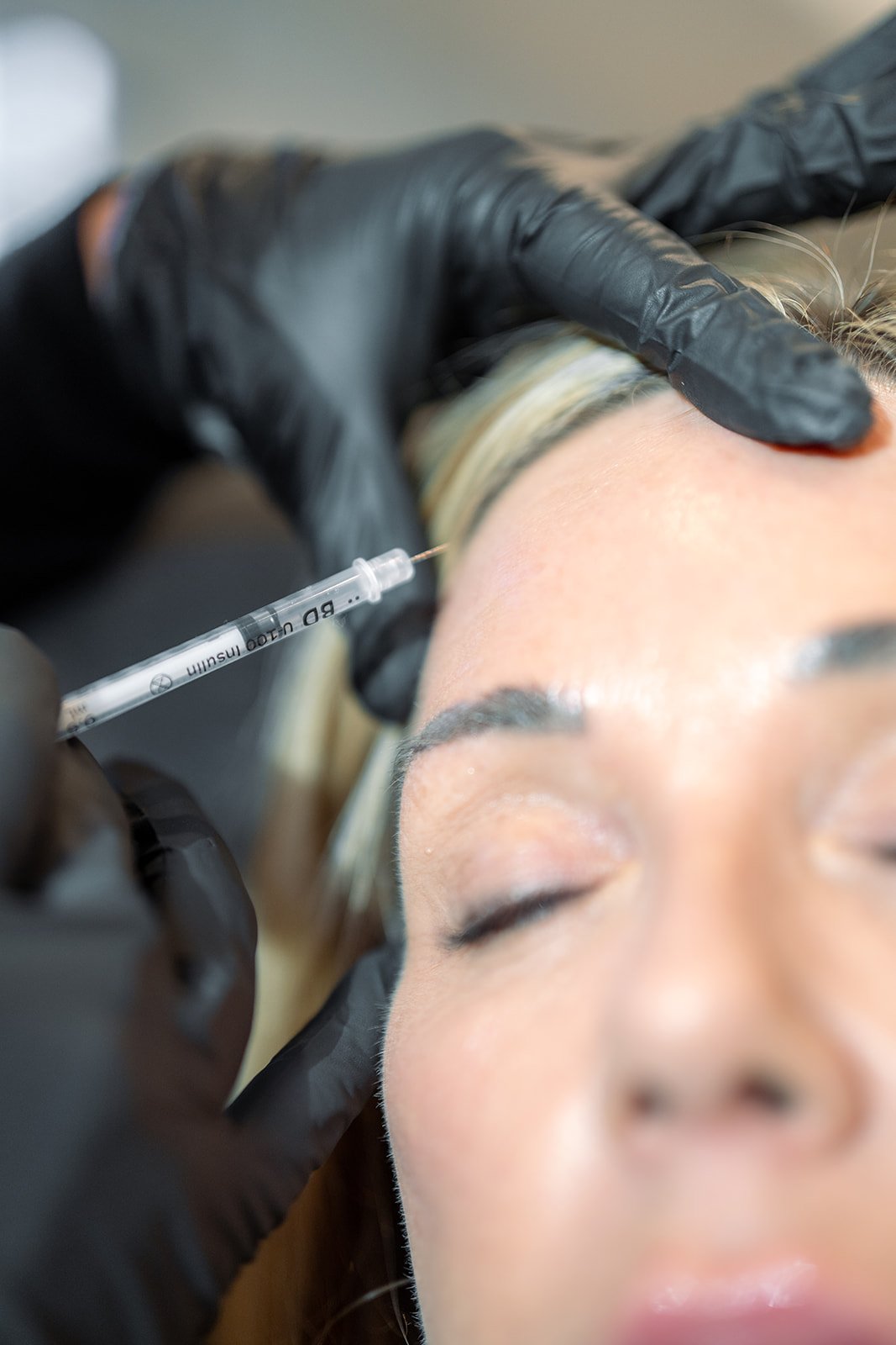 A woman getting botox on her forehead.