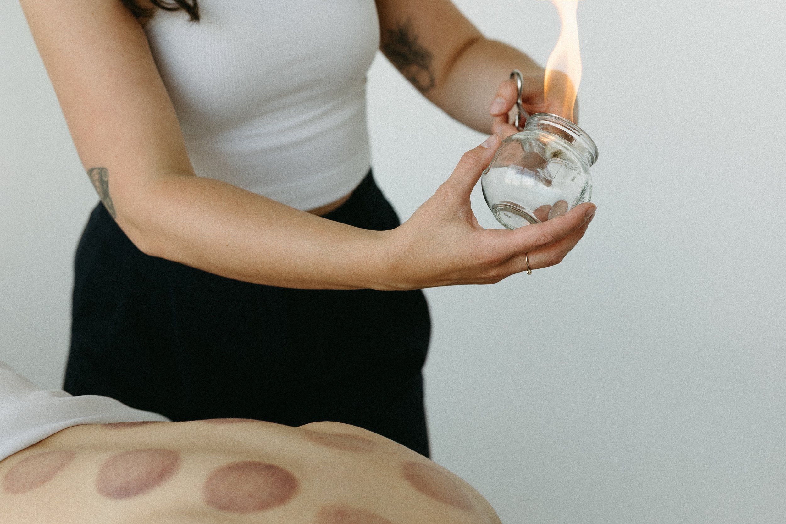 fire cupping calgary