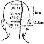 Diagram showing the location for UB9