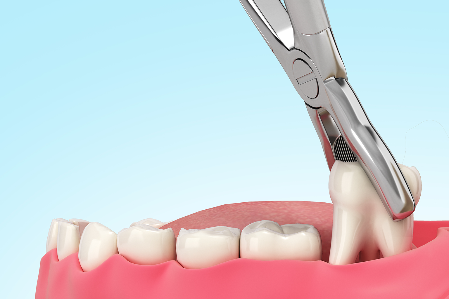 Oral Surgery