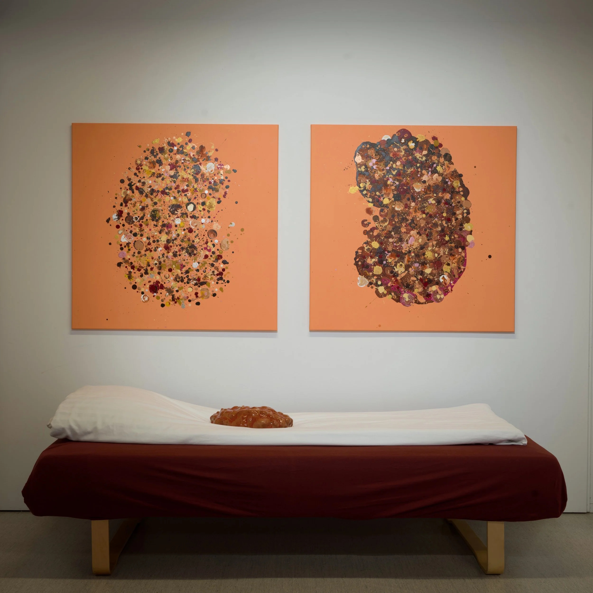 Adpkd and me (Cystenyreuniverset)