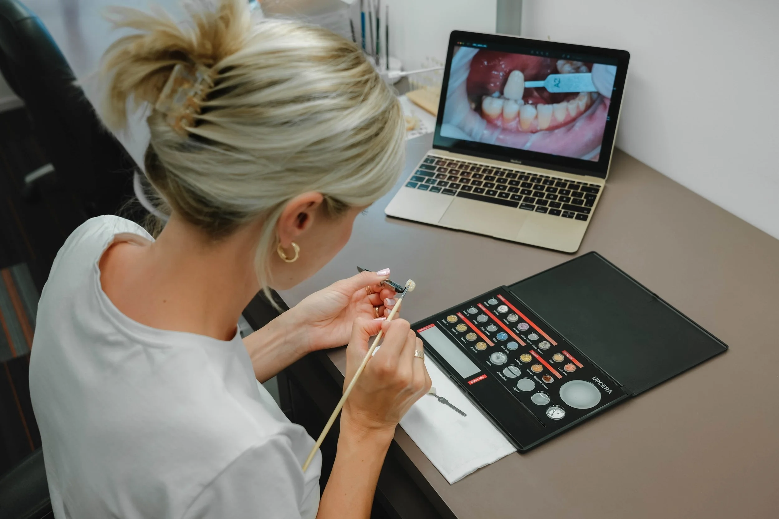 Implantaadi planeerimise keskus, hambarestauratsioonid