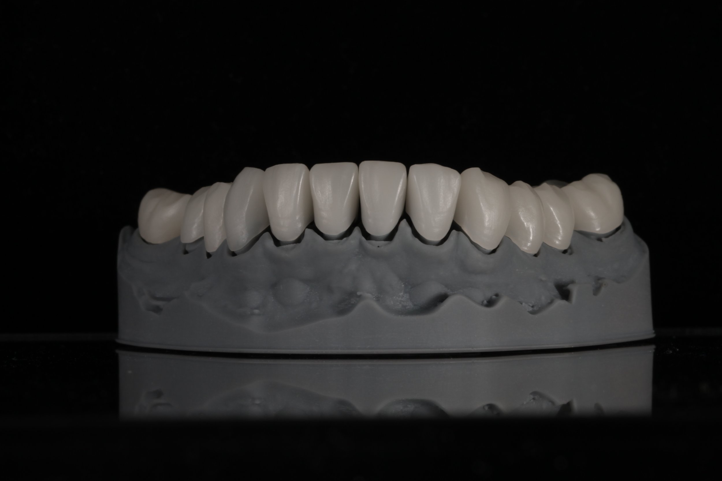 A dental prosthetic model showing a set of upper teeth on a gray base against a black background.