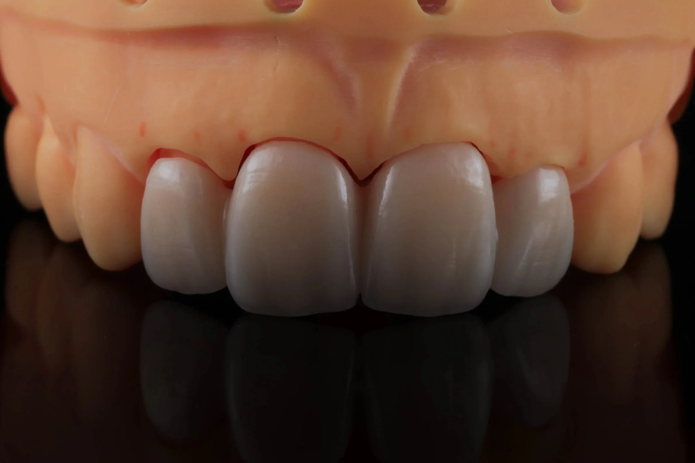 Close-up of doll teeth and gums, showing front teeth with a black surface reflection.