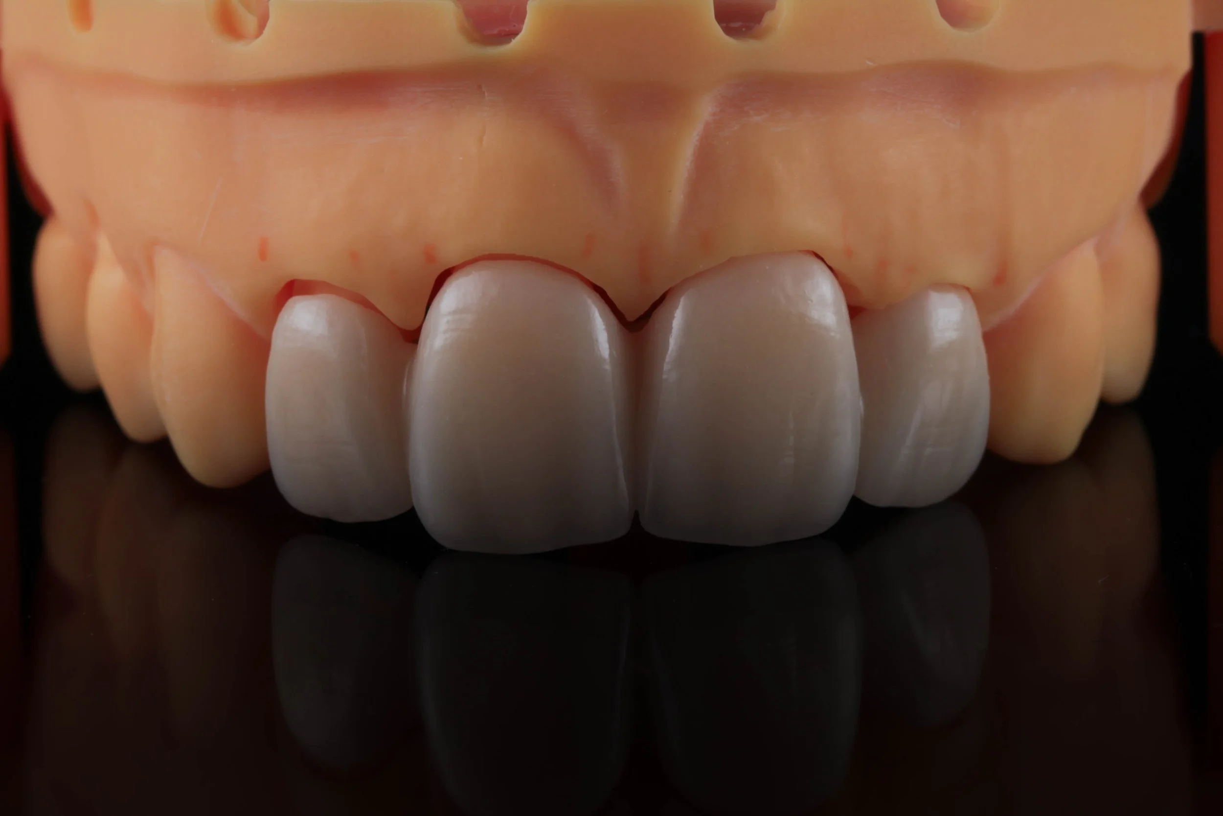 Een set kunstmatige tanden en kiezen in een tandheelkundige mal, met reflectie op een zwarte achtergrond.