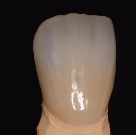 Close-up van een menselijke tand met glanzende glazuurlaag, zwart achtergrondelement.