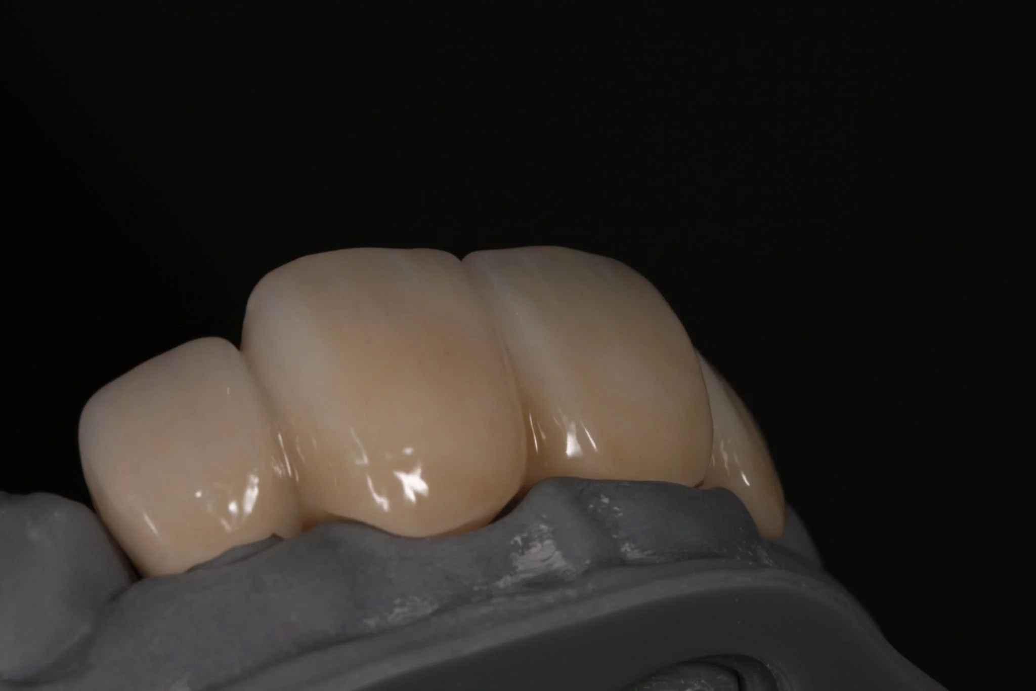 Close-up of a model or dental prosthetic teeth on a gray base against a black background.