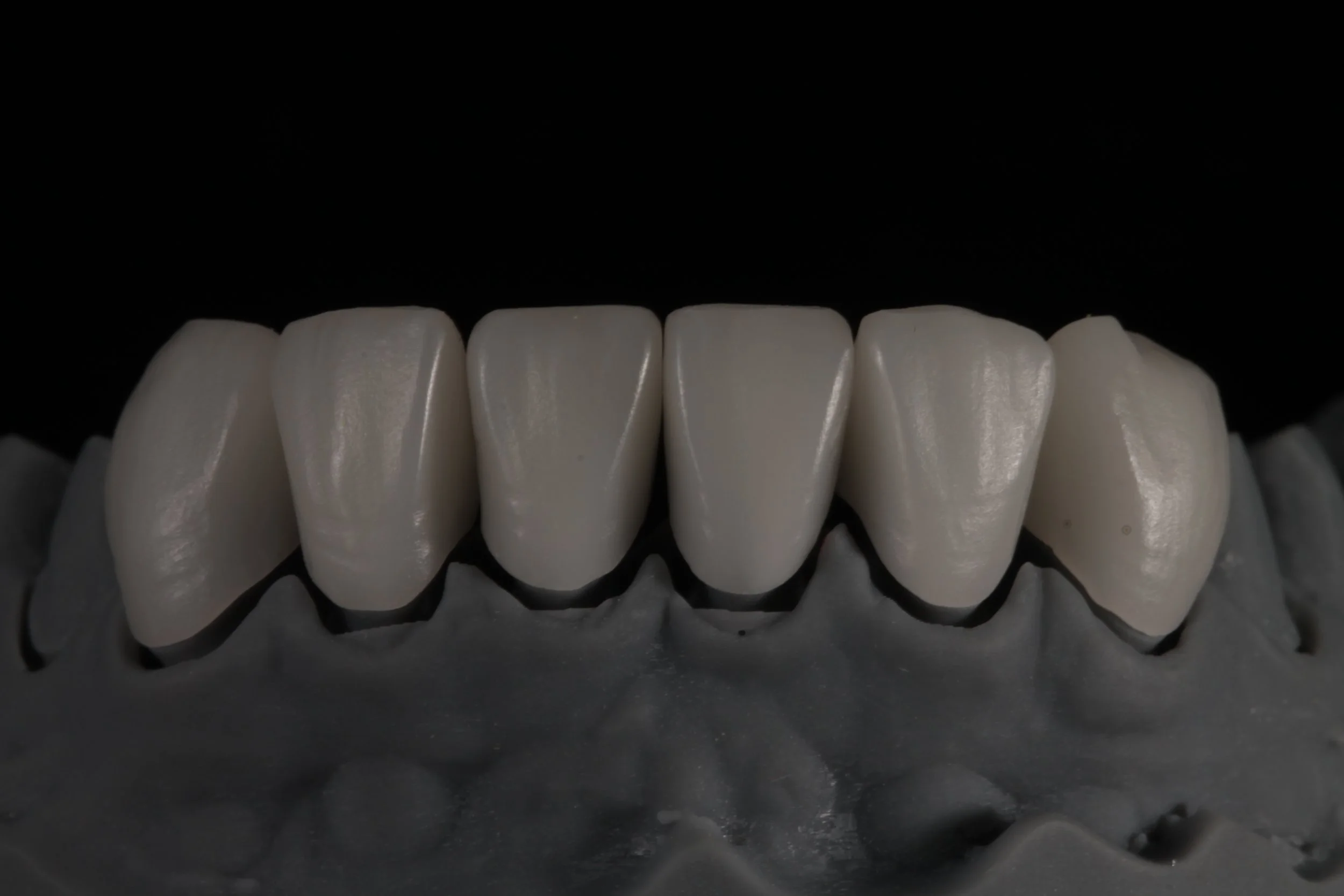 Close-up van een rij kunstmatige tanden op een chocolade structuur