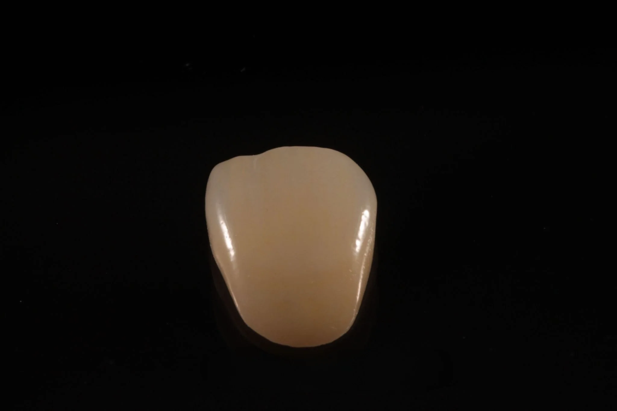 A close-up of a missing tooth with a tan-colored dental veneer or cap on a black background.