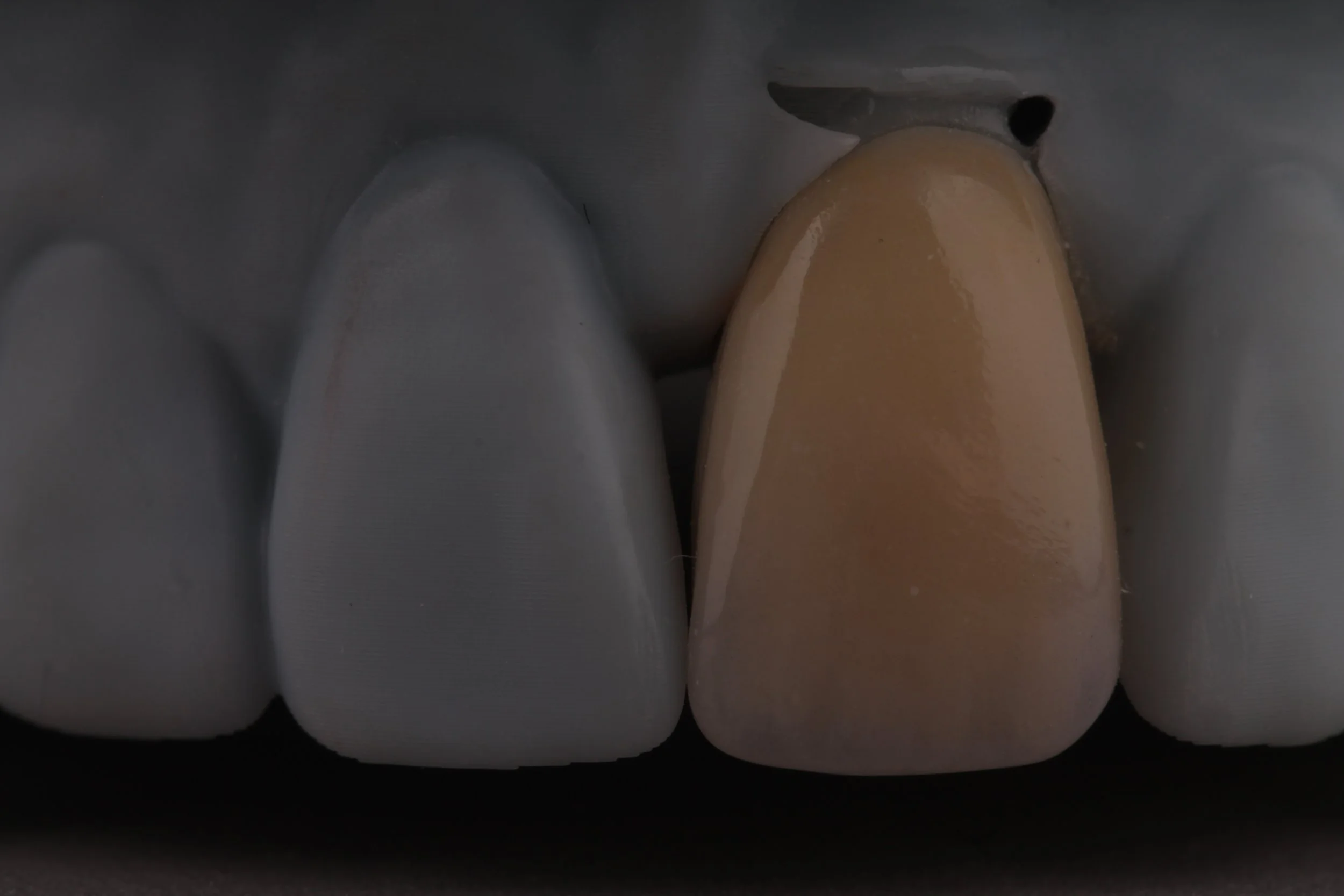 A close-up of several white and beige dental impression trays.