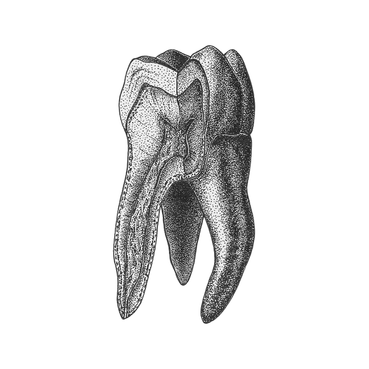Detailed black and white illustration of a molar tooth showing root and crown