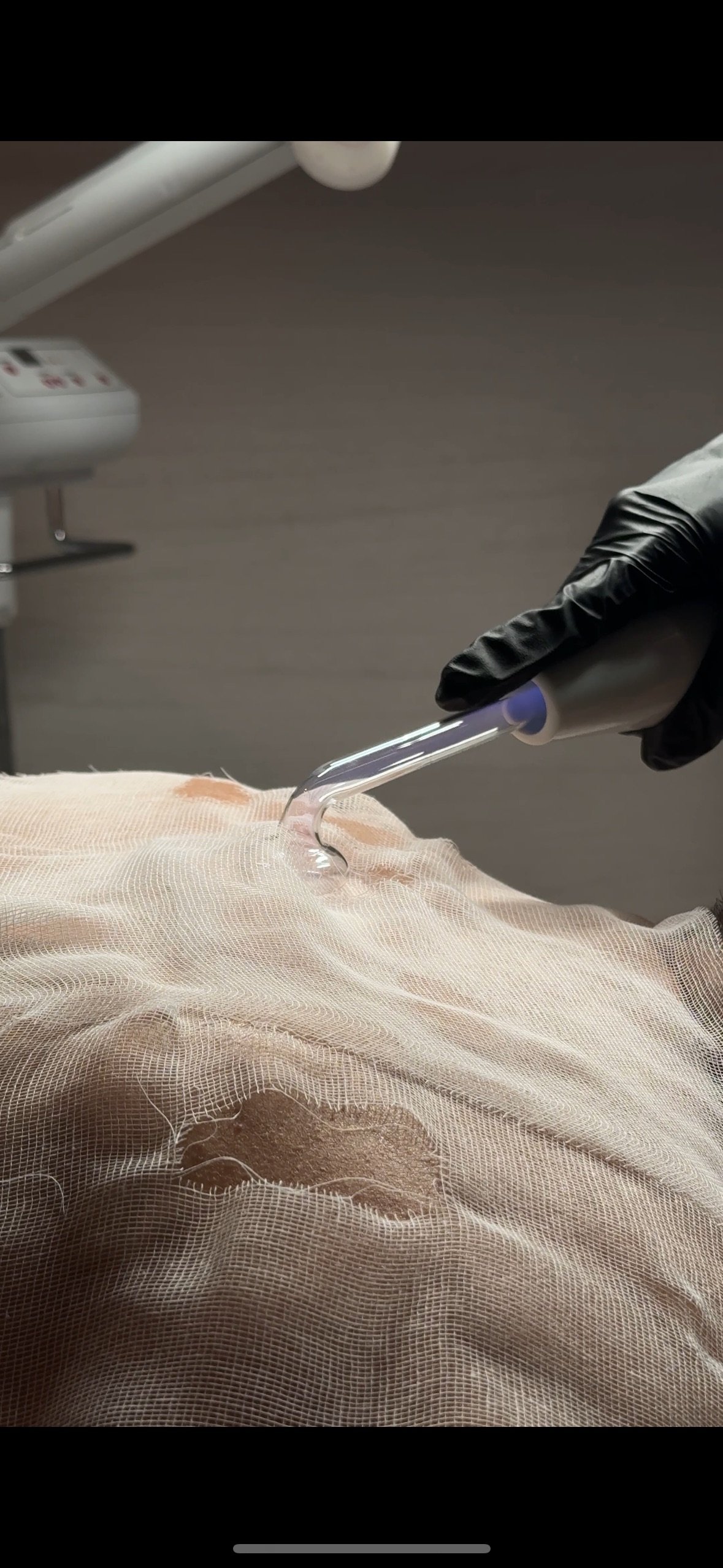 High frequency wand used to reduce bacteria and calm inflammation during a facial treatment.