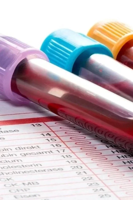 Three test tubes with colored caps (purple, blue, yellow) containing blood samples on a medical chart or laboratory report.