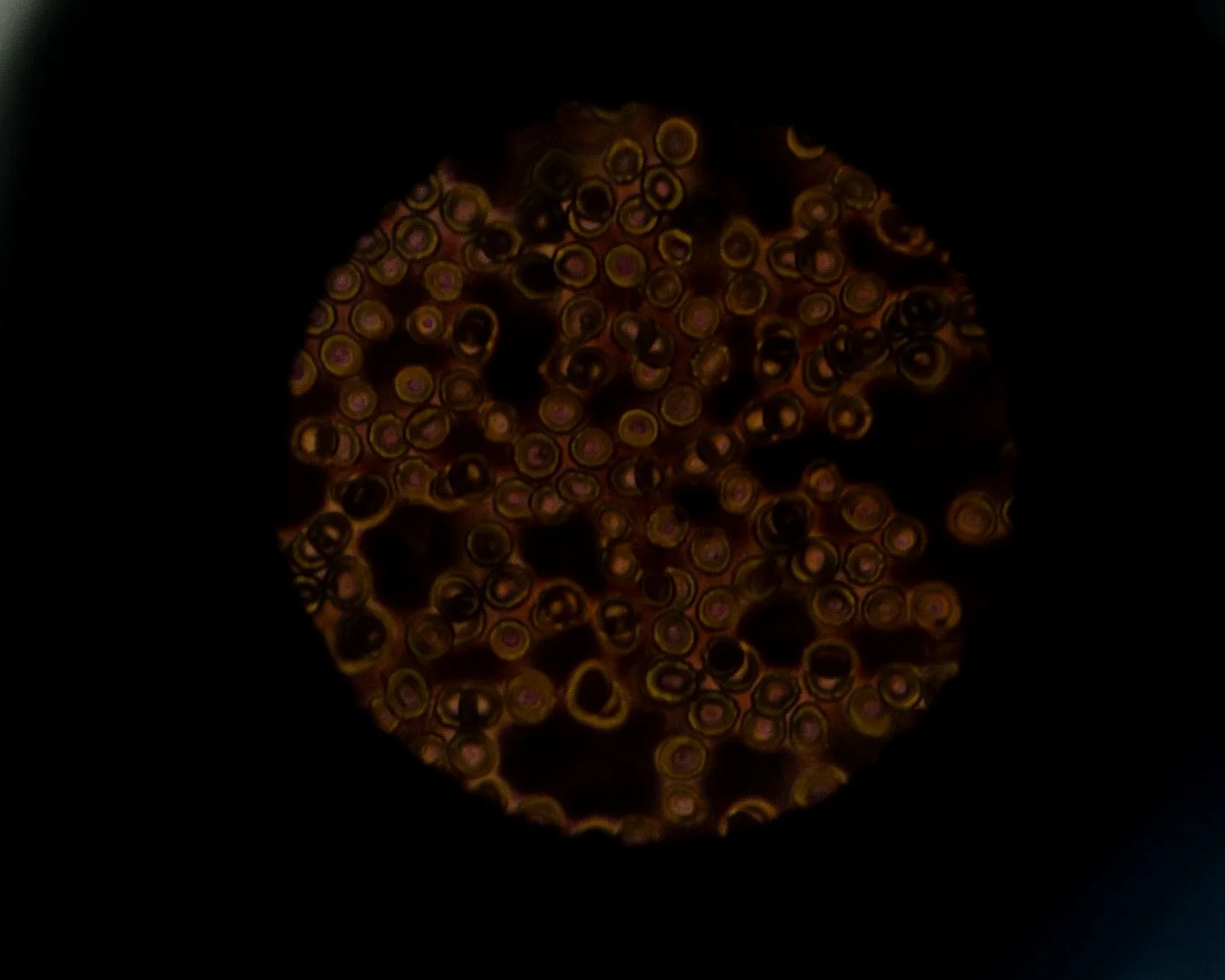 Close-up of a cluster of small, round objects with a yellowish-brown color and concentric rings, set against a black background.