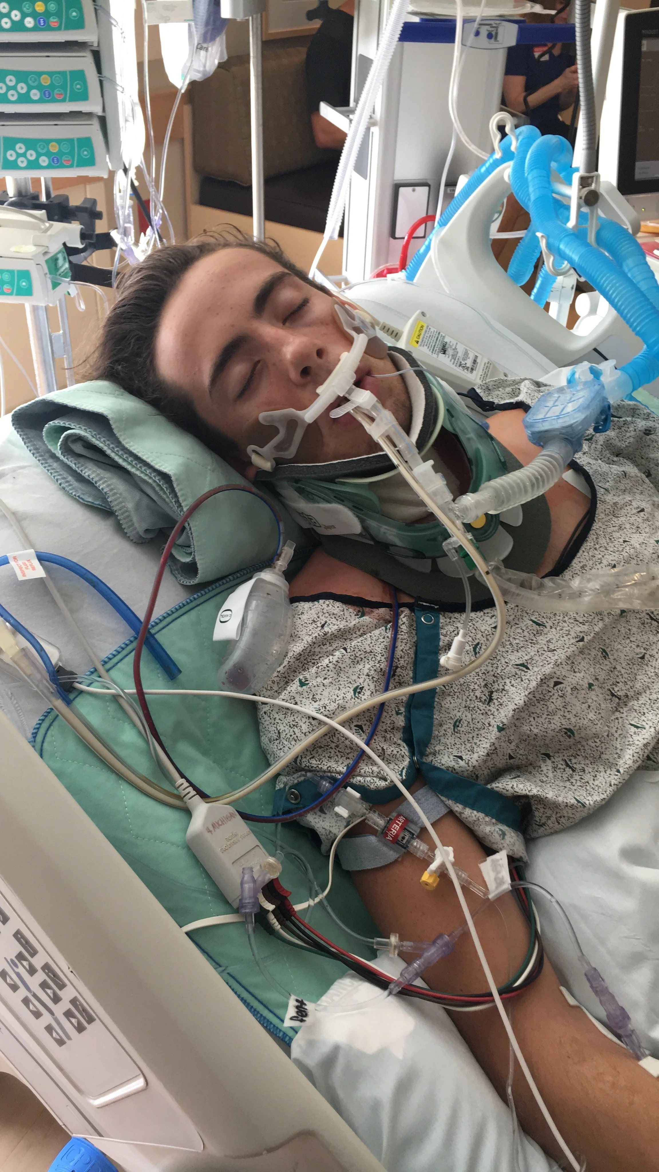 A young man in a hospital bed connected to various medical devices, with a breathing tube in his mouth, receiving medical care.