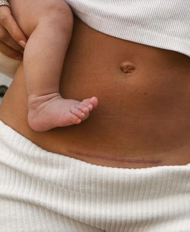 Close-up of a pregnant woman's bare belly with a newborn's arm and hand resting on it.