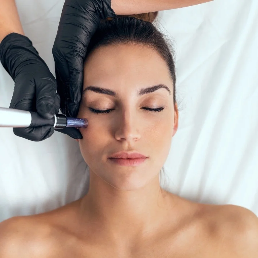Skin Needling