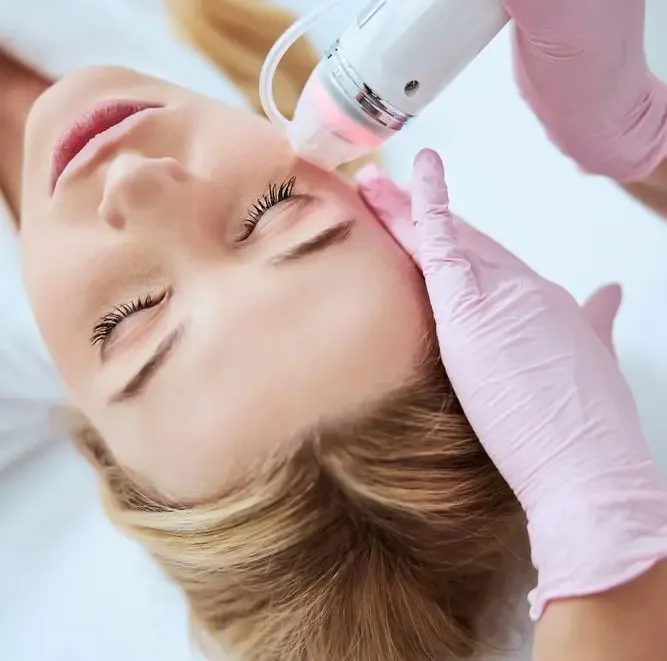 RF Skin Needling - Full Face