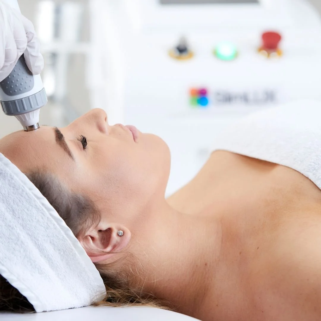 RF Skin Tightening Facial