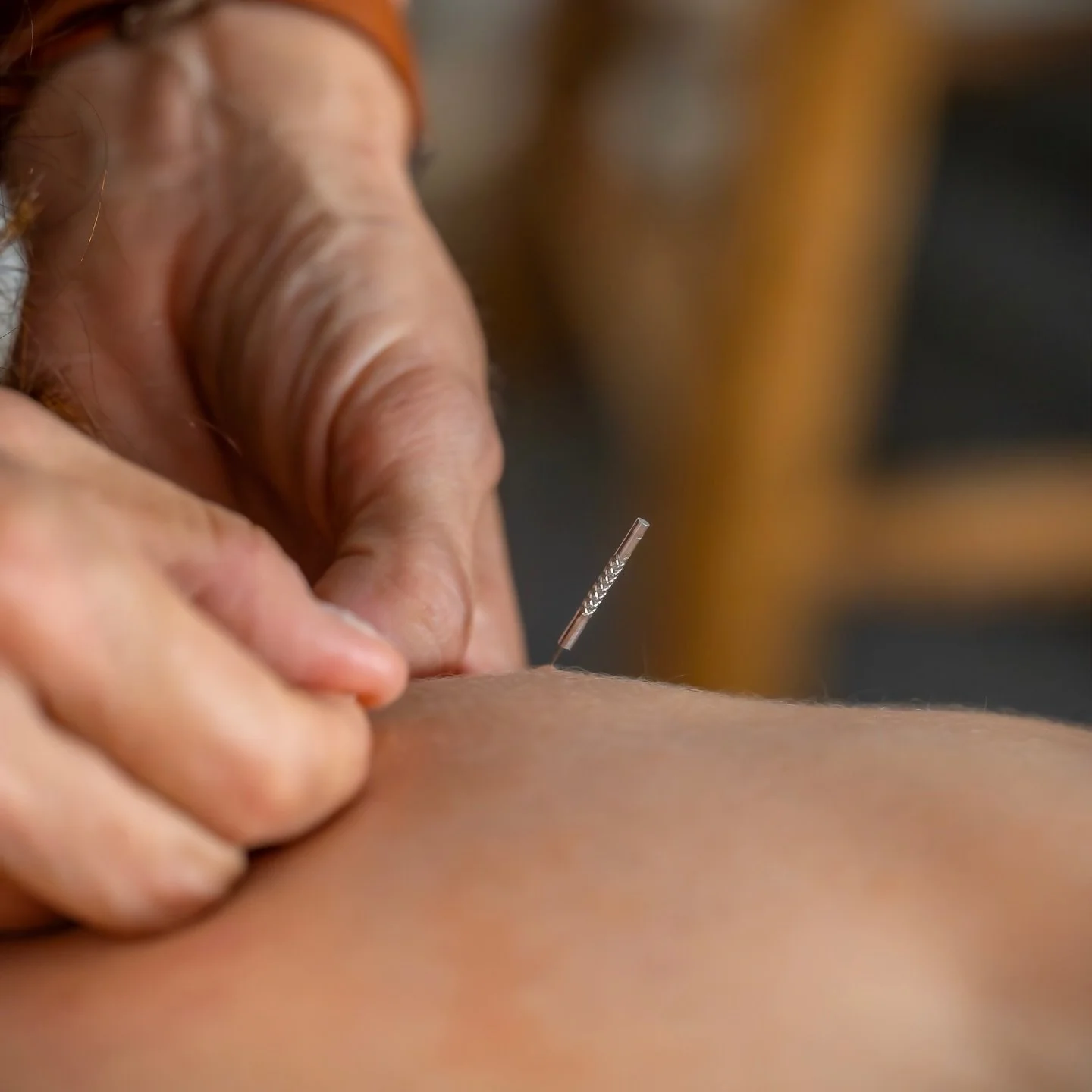MYOFASCIAL DRY NEEDLING
The key thing I&rsquo;ve noticed&mdash;something many practitioners never mention, and perhaps aren&rsquo;t even aware of&mdash;is how quickly this tool can invite someone back into their body, and even more importantly, back 