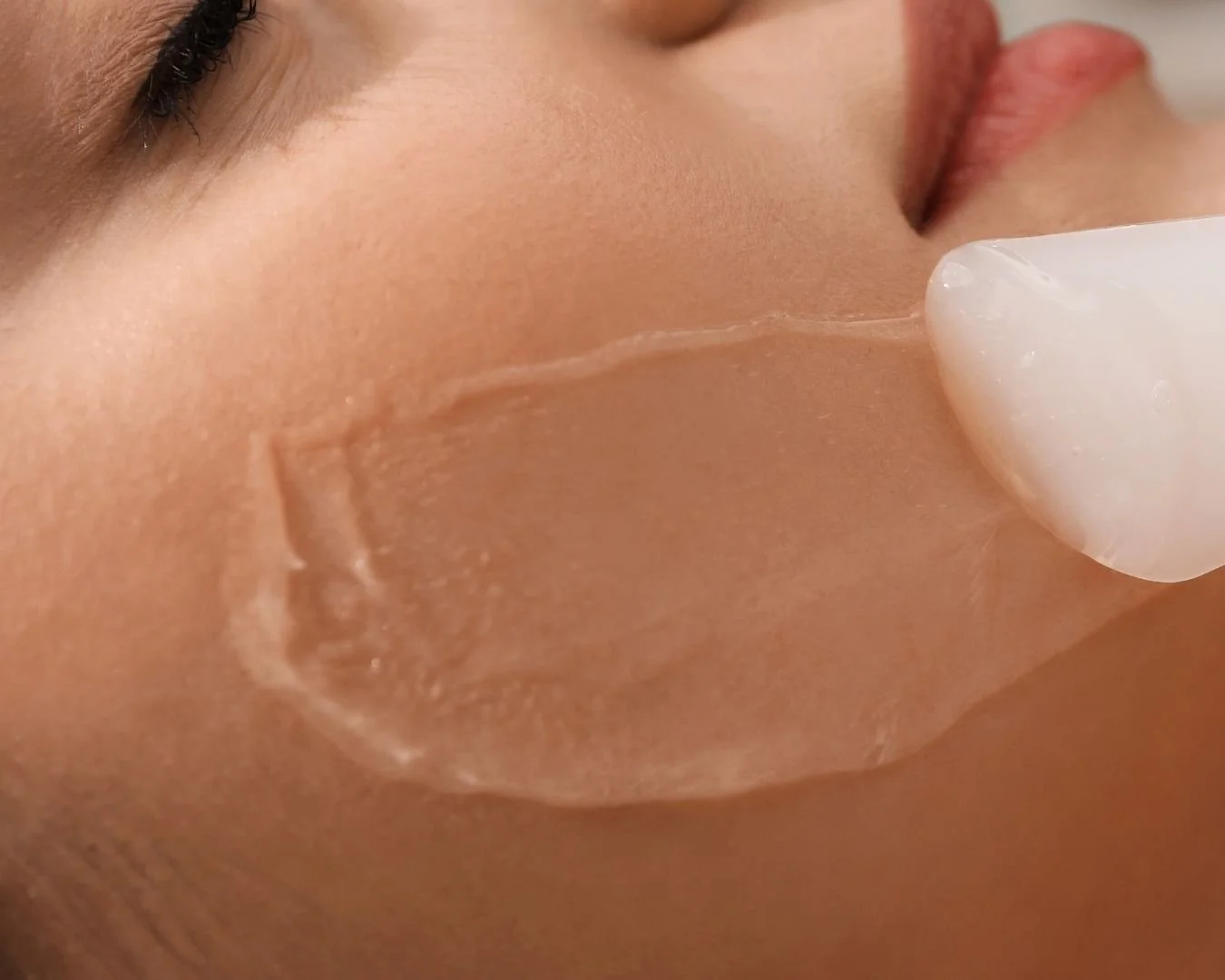 Close-up of a person with closed eyes laying down, with a large ice cube on their face.