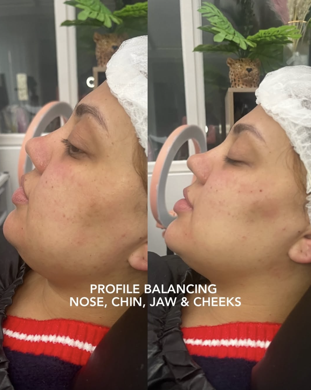 Before and After Facial Profiling 1