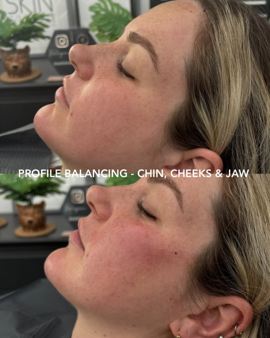 Before and After Facial Profiling 3