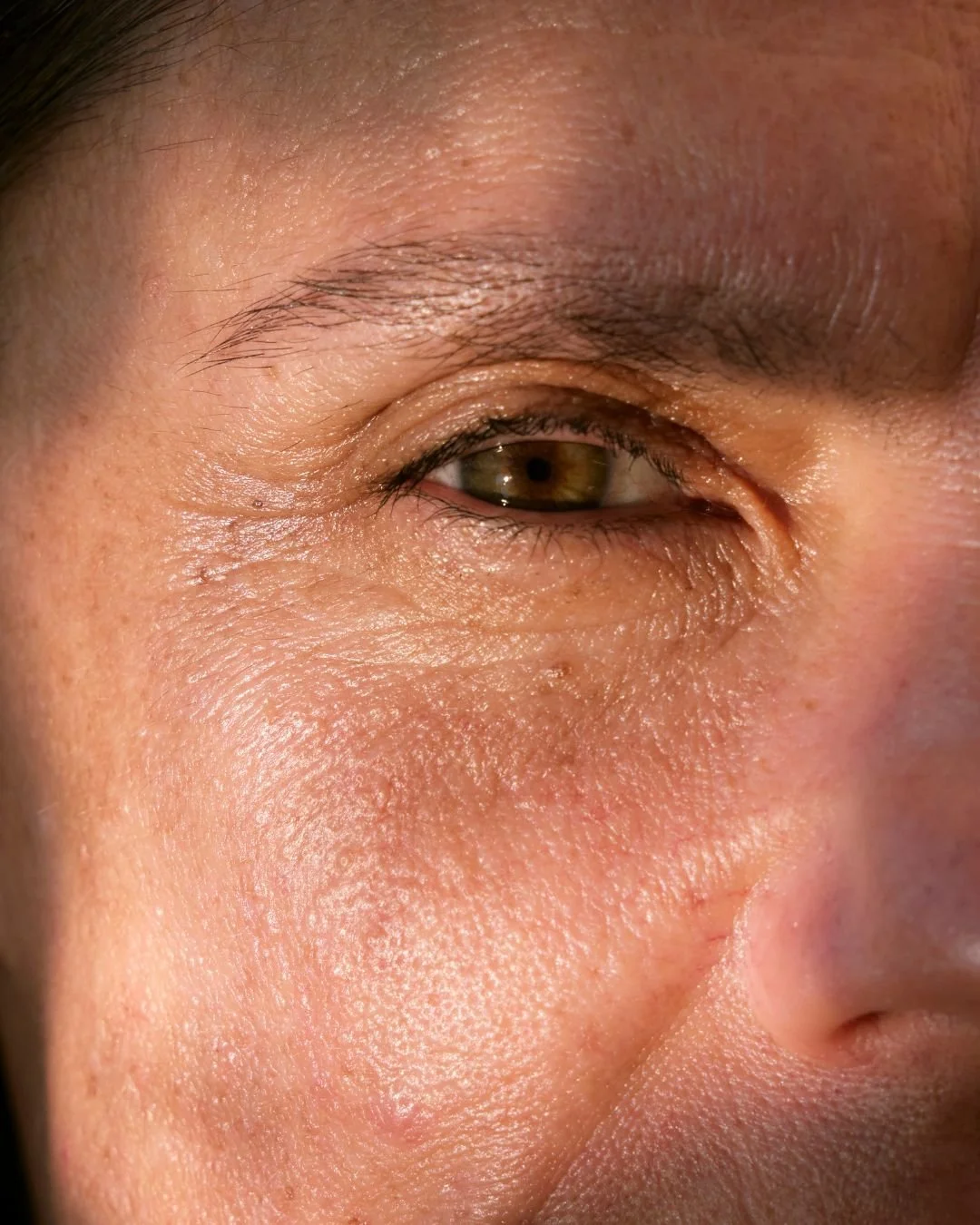Woman with wrinkles around eyes