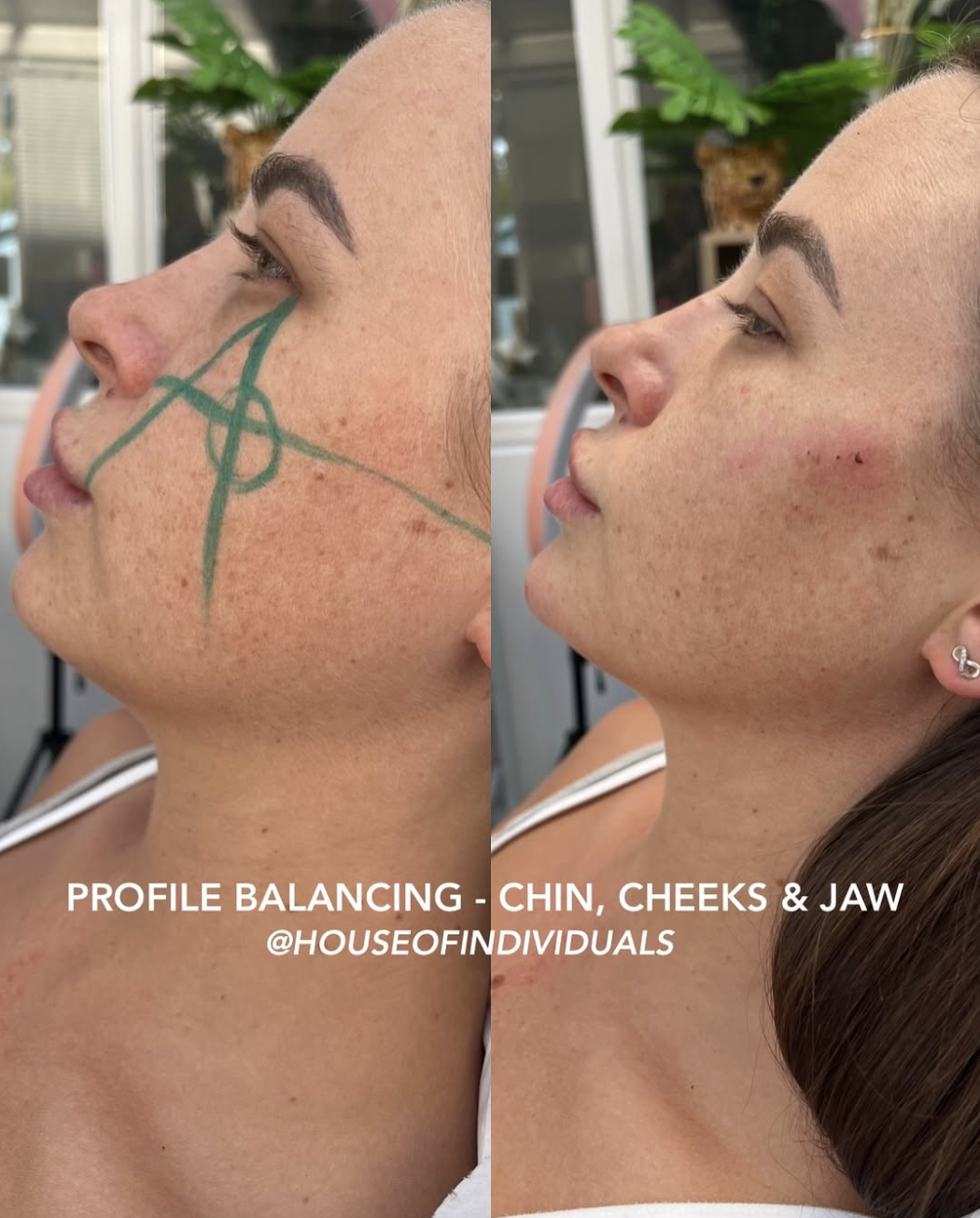 Before and After Facial Profiling 2