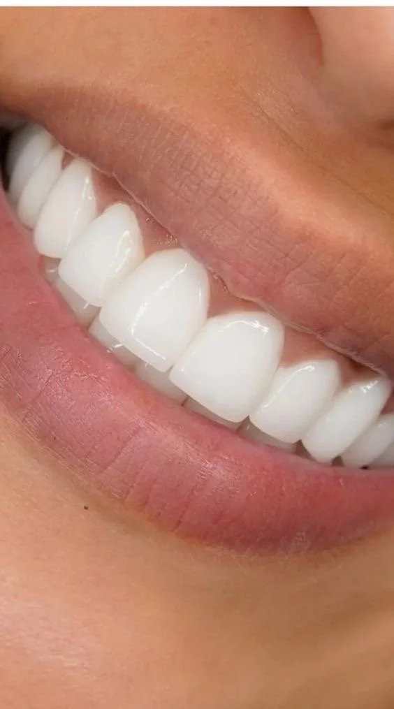Close-up of a person showing white teeth and part of their lips in a smiling expression.