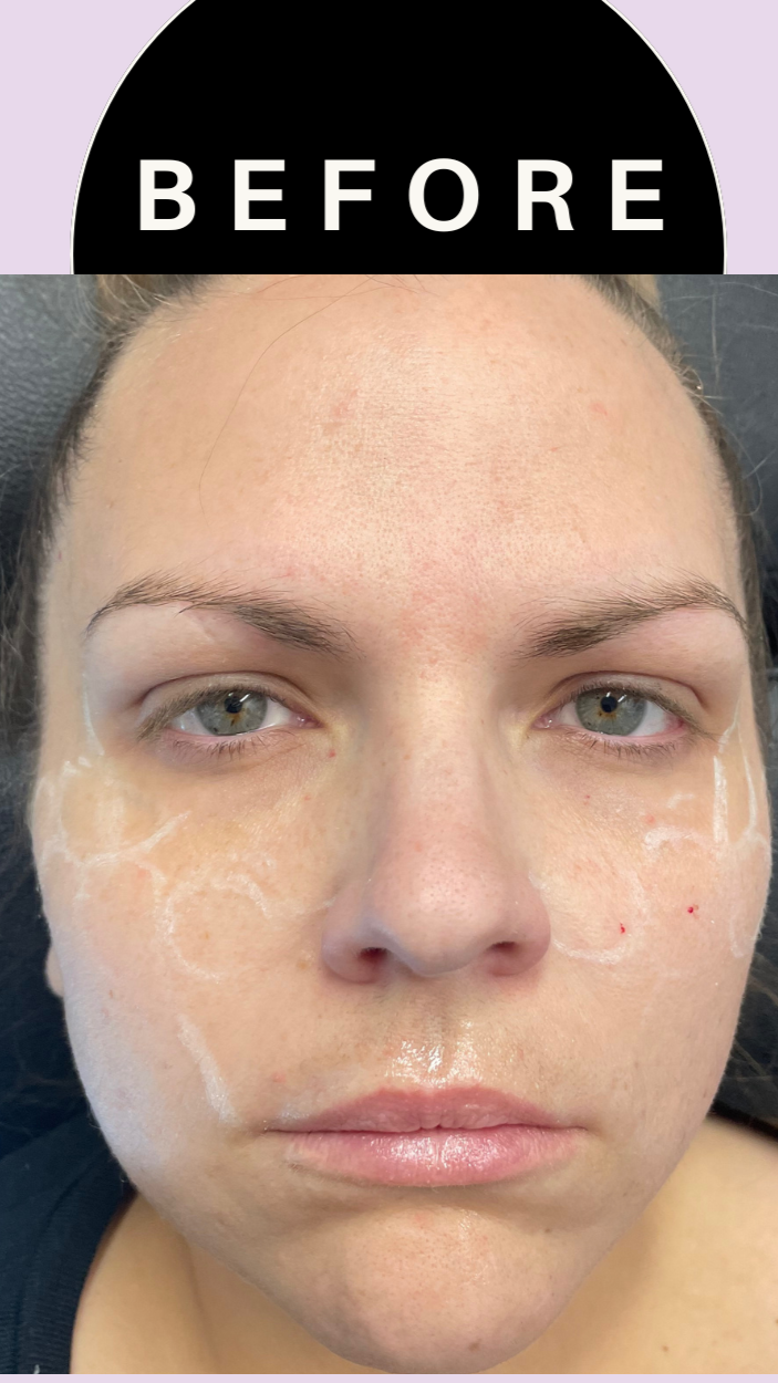 Green+and+Beige+Minimalist+Skincare+Before+After+Collage+Instagram+Post+%286%29.png