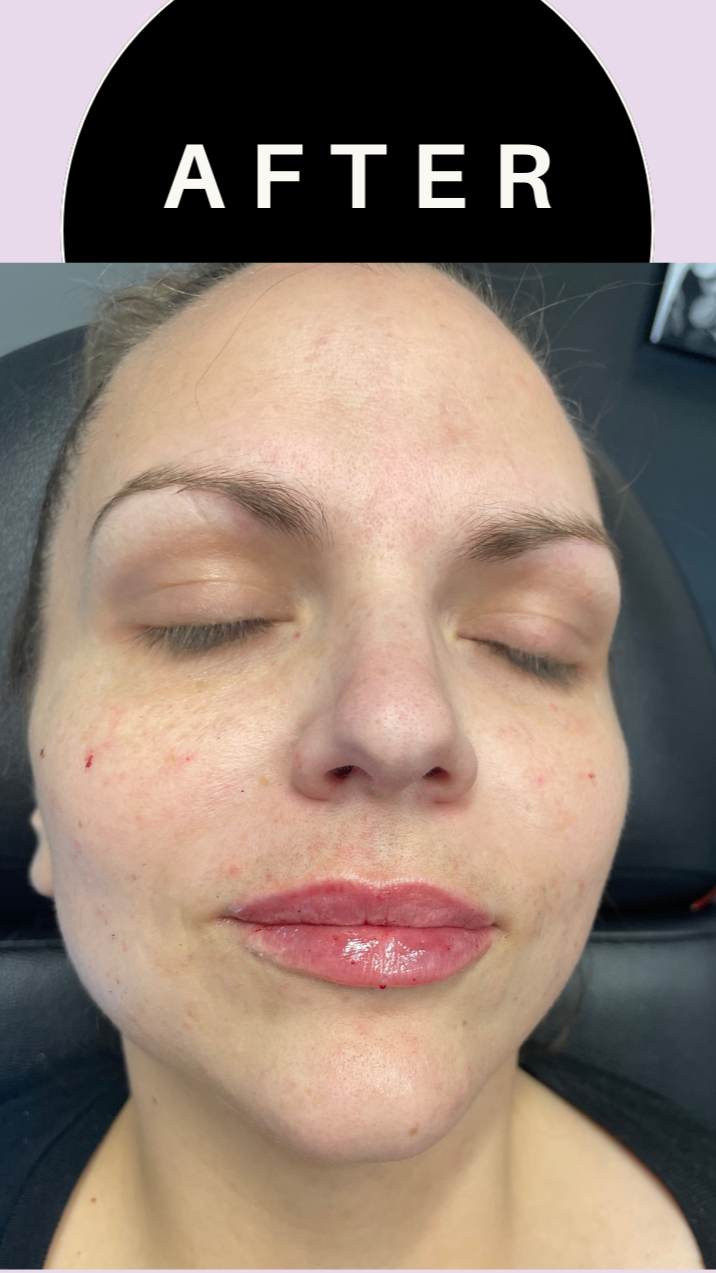 Green+and+Beige+Minimalist+Skincare+Before+After+Collage+Instagram+Post+%287%29.png