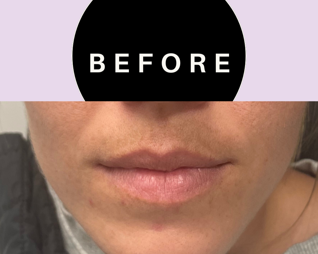 Green+and+Beige+Minimalist+Skincare+Before+After+Collage+Instagram+Post+%284%29.png