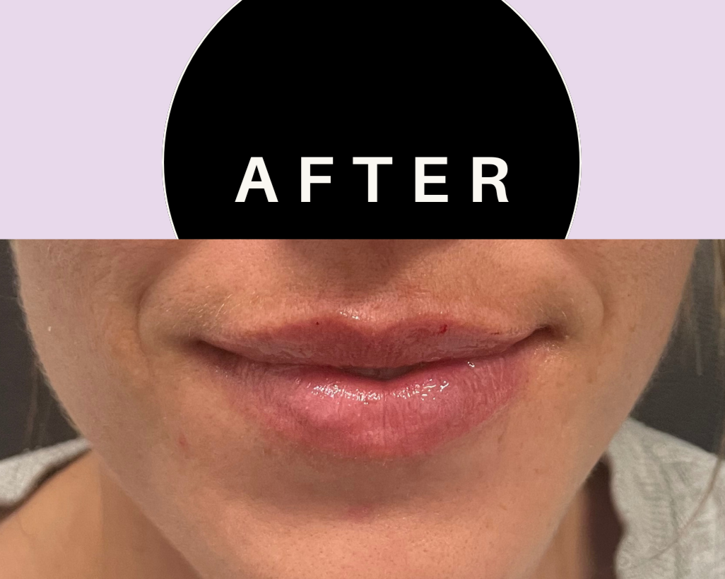 Green+and+Beige+Minimalist+Skincare+Before+After+Collage+Instagram+Post+%285%29.png