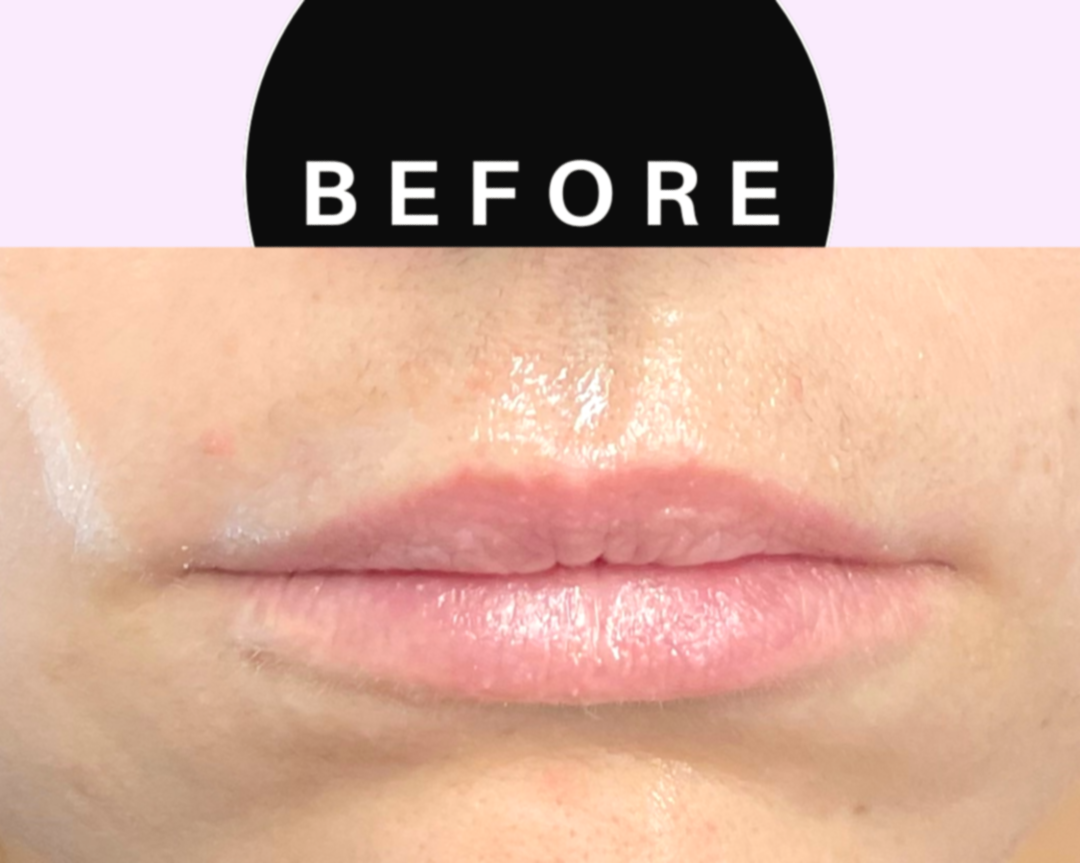 Green%2Band%2BBeige%2BMinimalist%2BSkincare%2BBefore%2BAfter%2BCollage%2BInstagram%2BPost%2B%25282%2529.png