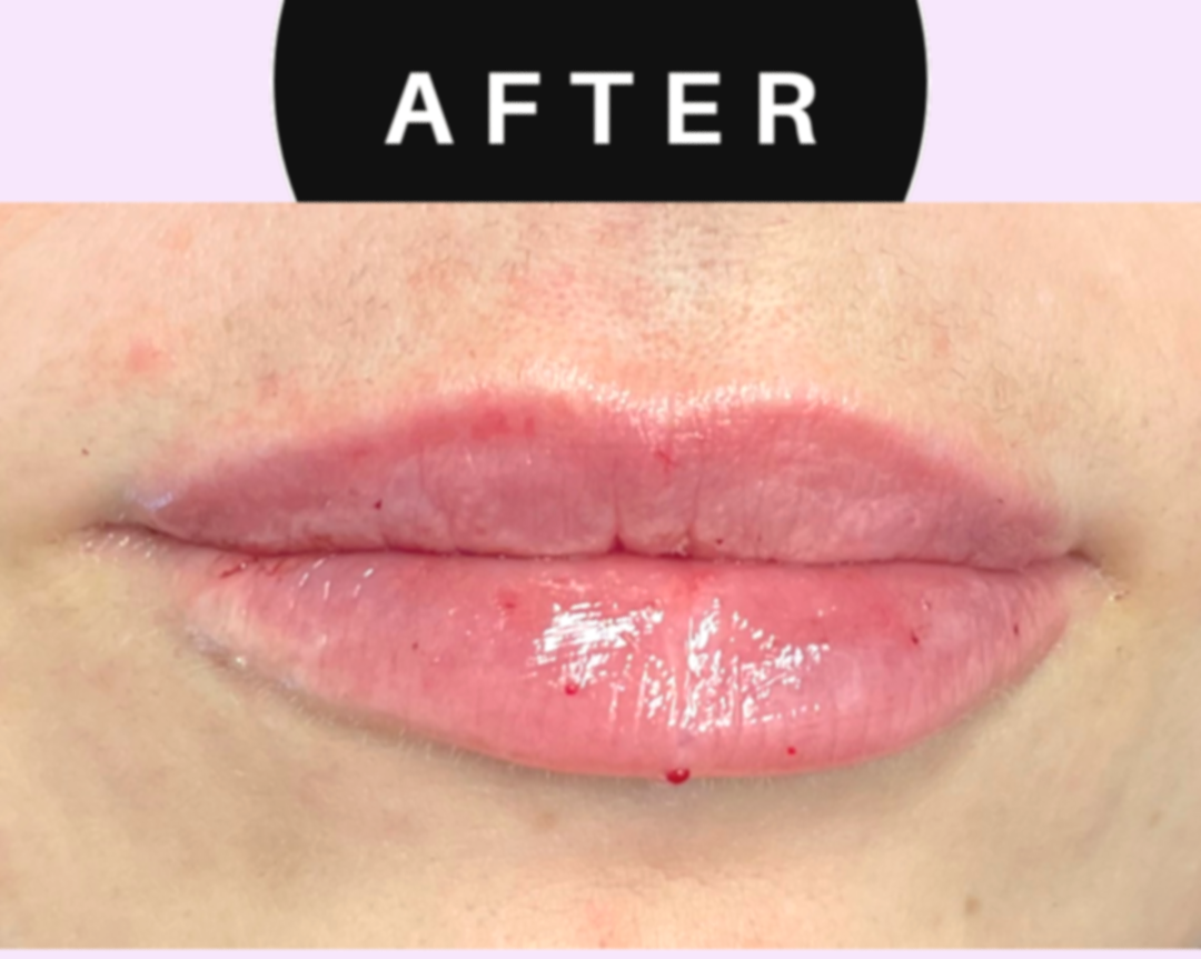 Green%2Band%2BBeige%2BMinimalist%2BSkincare%2BBefore%2BAfter%2BCollage%2BInstagram%2BPost%2B%25281%2529.png